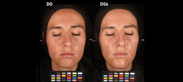 Clinical Study Image