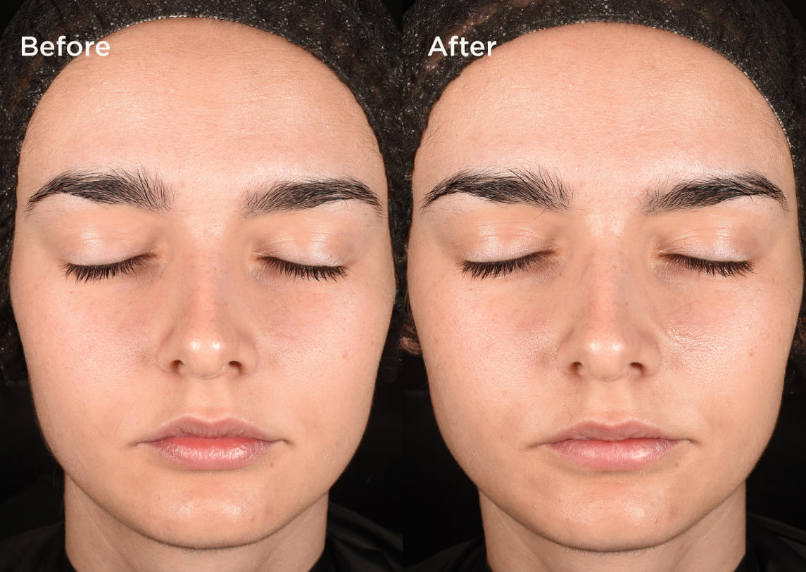 Measured by science Proven on skin