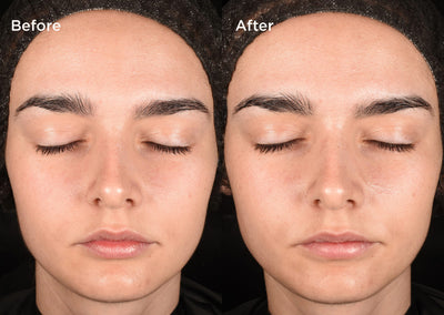 Measured by science Proven on skin