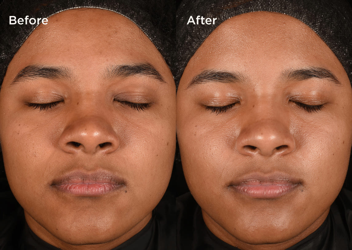 Measured by science Proven on skin