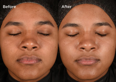 Measured by science Proven on skin