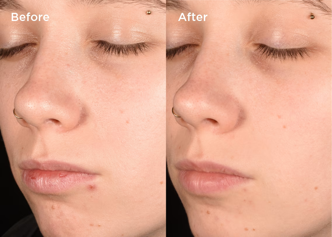 Measured by science. Proven on skin