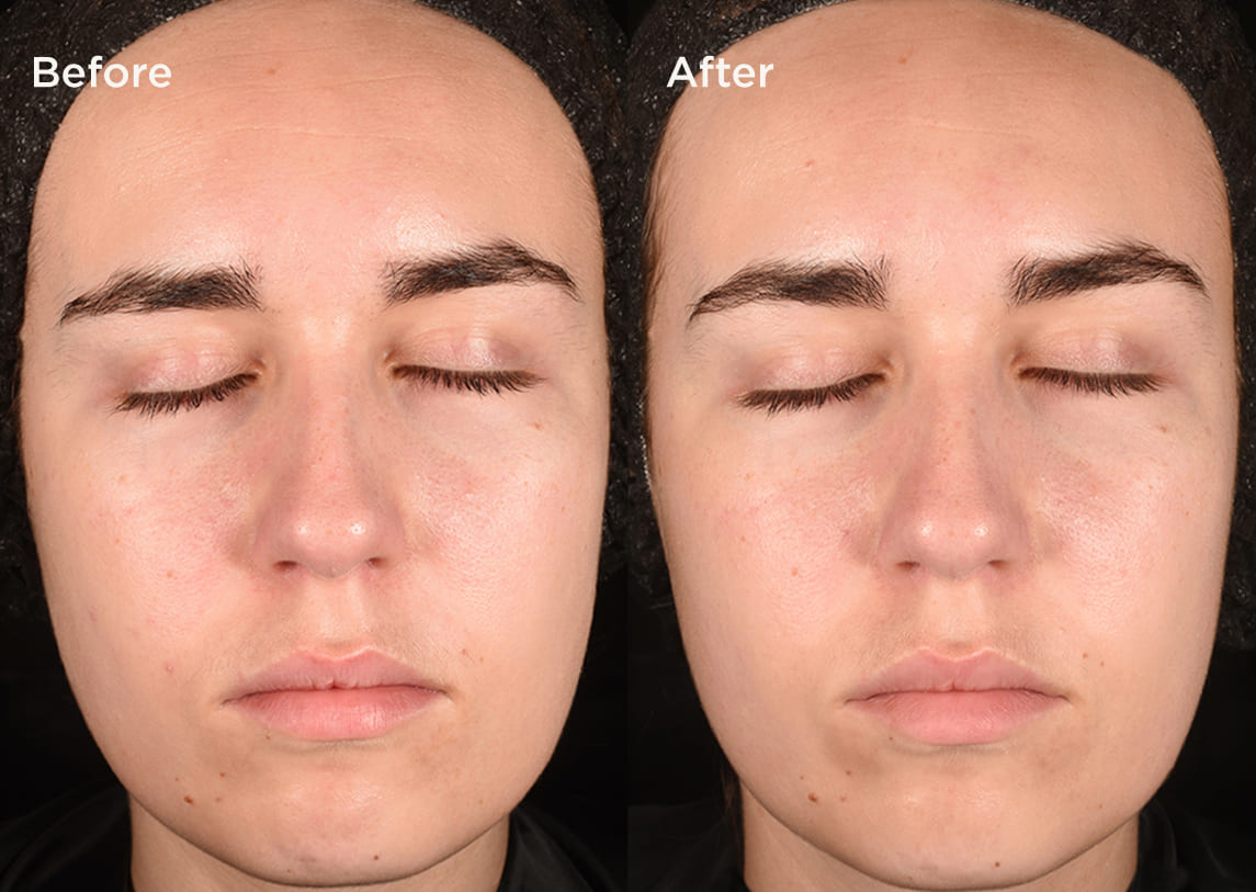 Measured by science Proven on skin