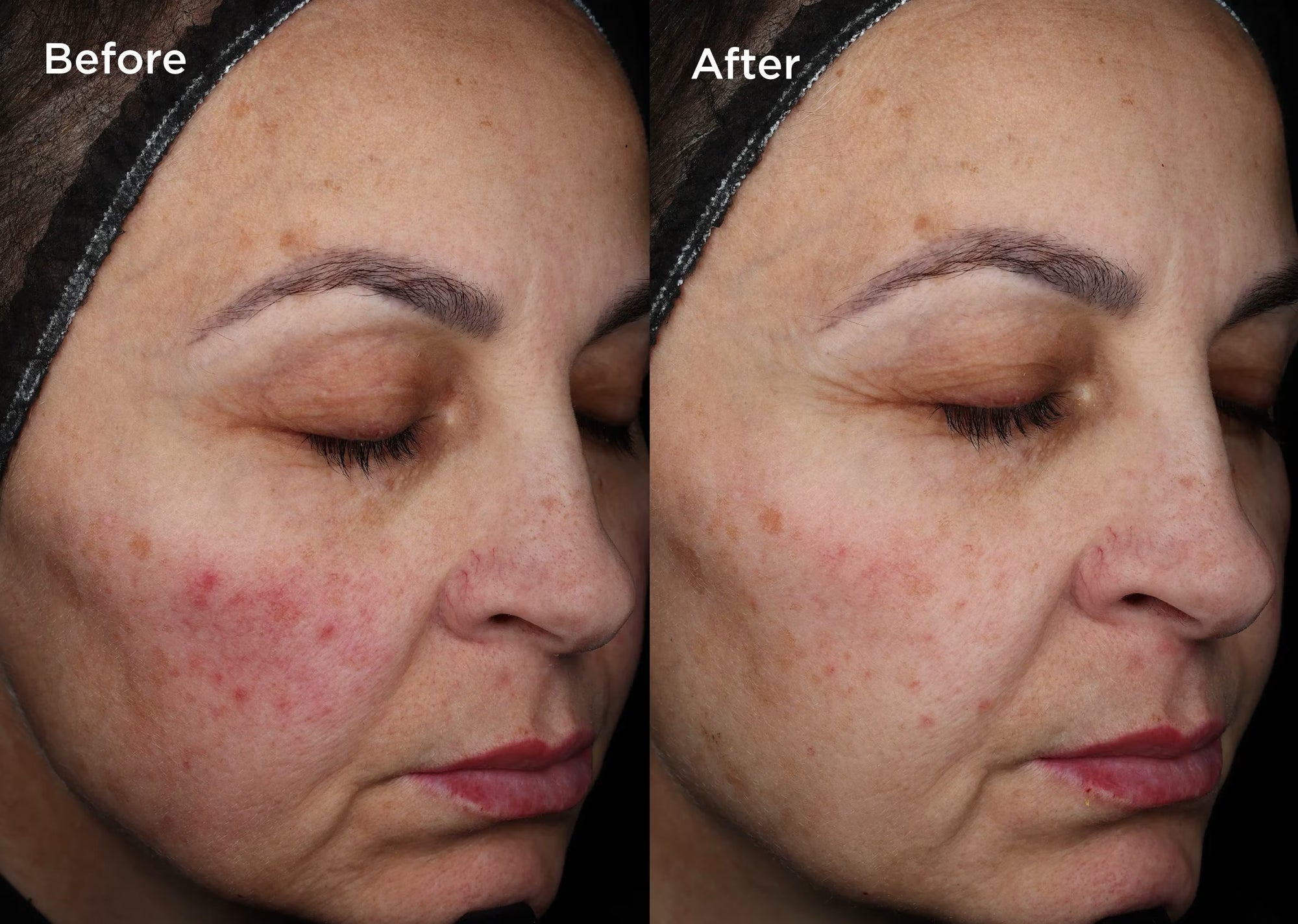R-2 Sparkling Water Brightening Face Toner