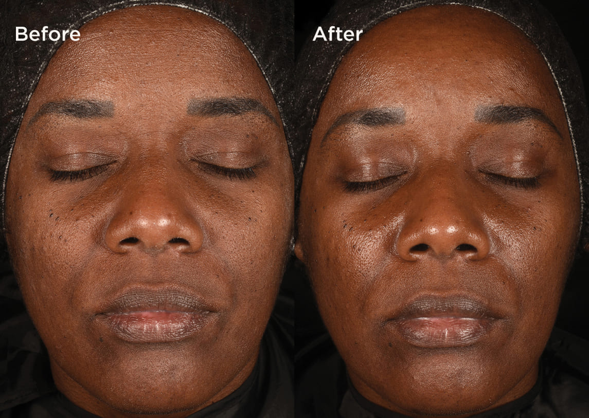 Measured by science Proven on skin