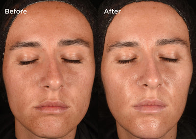 Measured by science Proven on skin