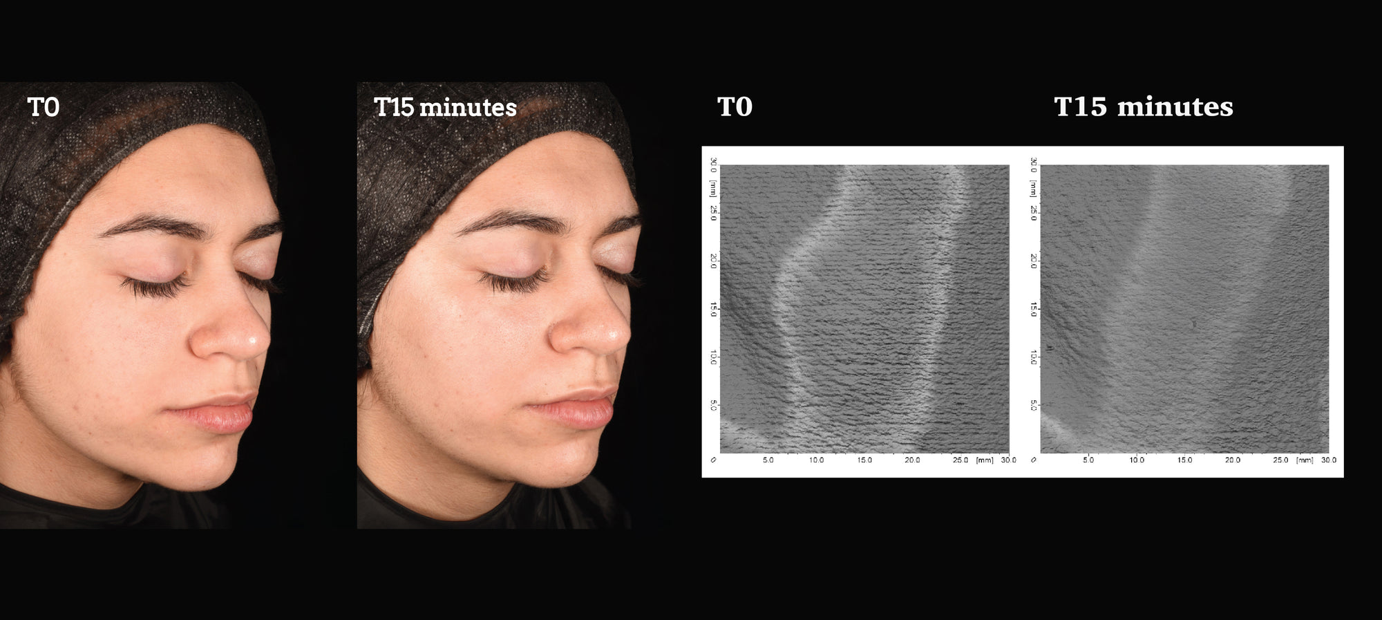 Measured by science Proven on skin