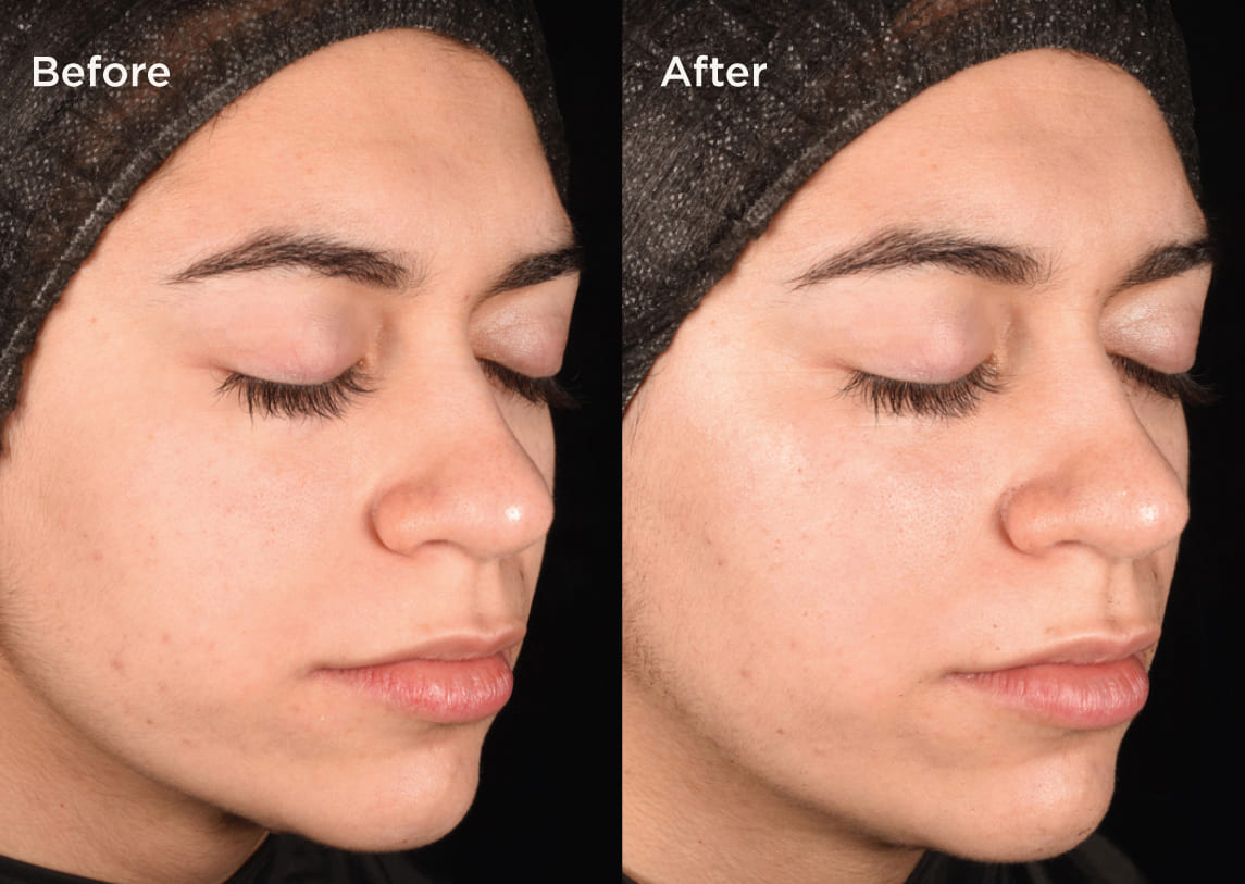 Measured by science Proven on skin