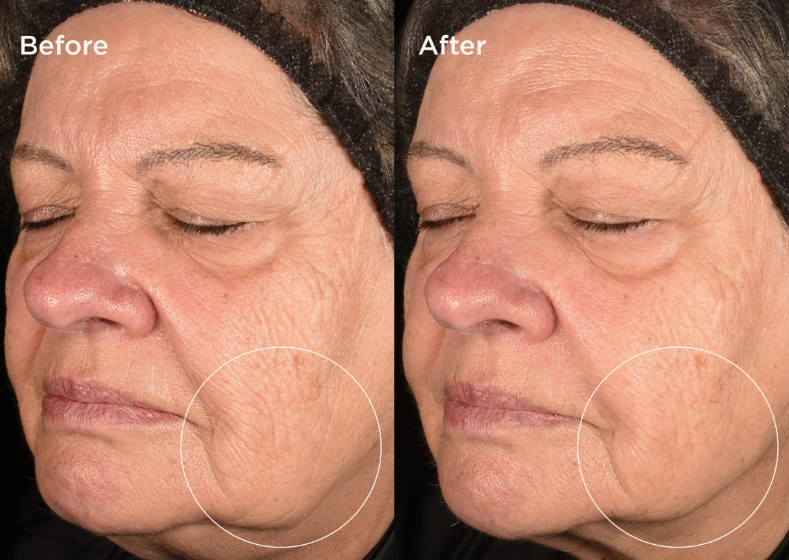 Measured by science Proven on skin