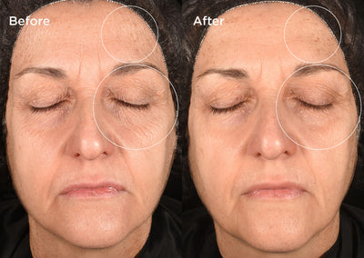 Measured by science Proven on skin