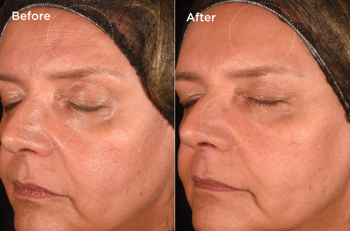 Measured by science Proven on skin