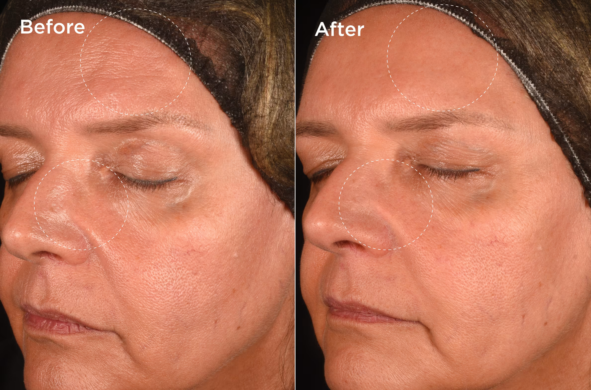 Y-4 Advanced Youth Complex Moisturizer